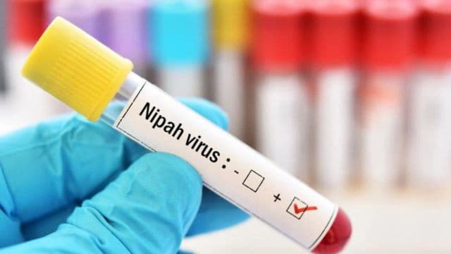 Kerala boy contracts Nipah virus