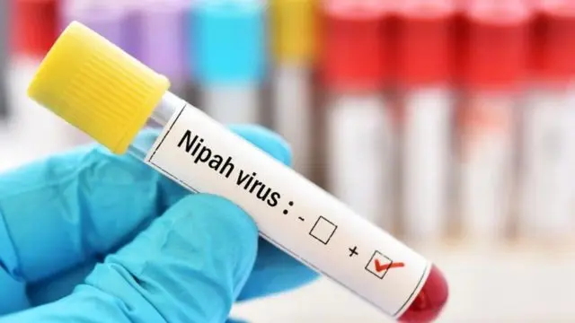 Nipah virus