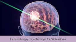 Glioblastoma