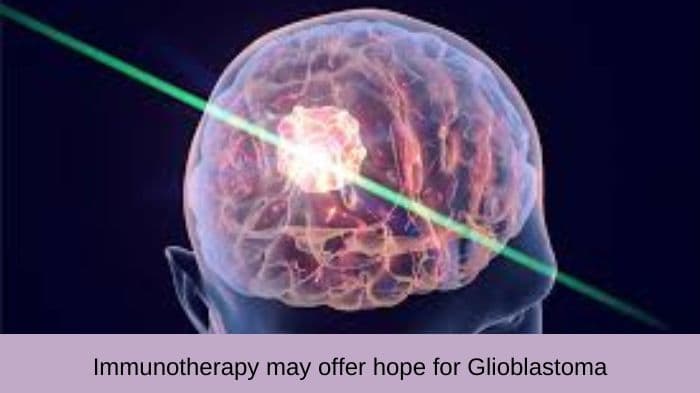 Glioblastoma