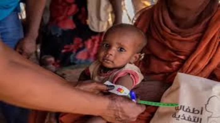 A consensus-driven evaluation of acute malnutrition, severe food insecurity, and population displacement in countries and regions identified as facing food crises in 2024