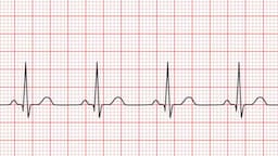 ECG