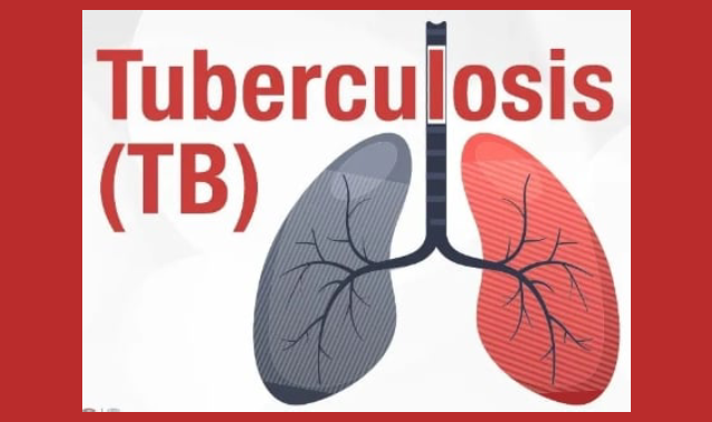 India TB Report 2024: Progress, Challenges, and Strategies