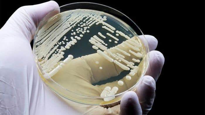 Candida auris develops new way to survive antifungal treatment, study finds